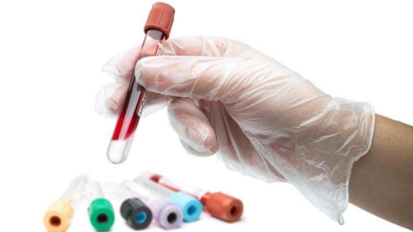 Xét nghiệm máu là xác định cơ thể thừa muối chính xác nhất