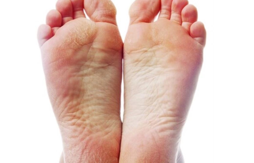 Dấu hiệu của bàn chân cho biết tình trạng của gan